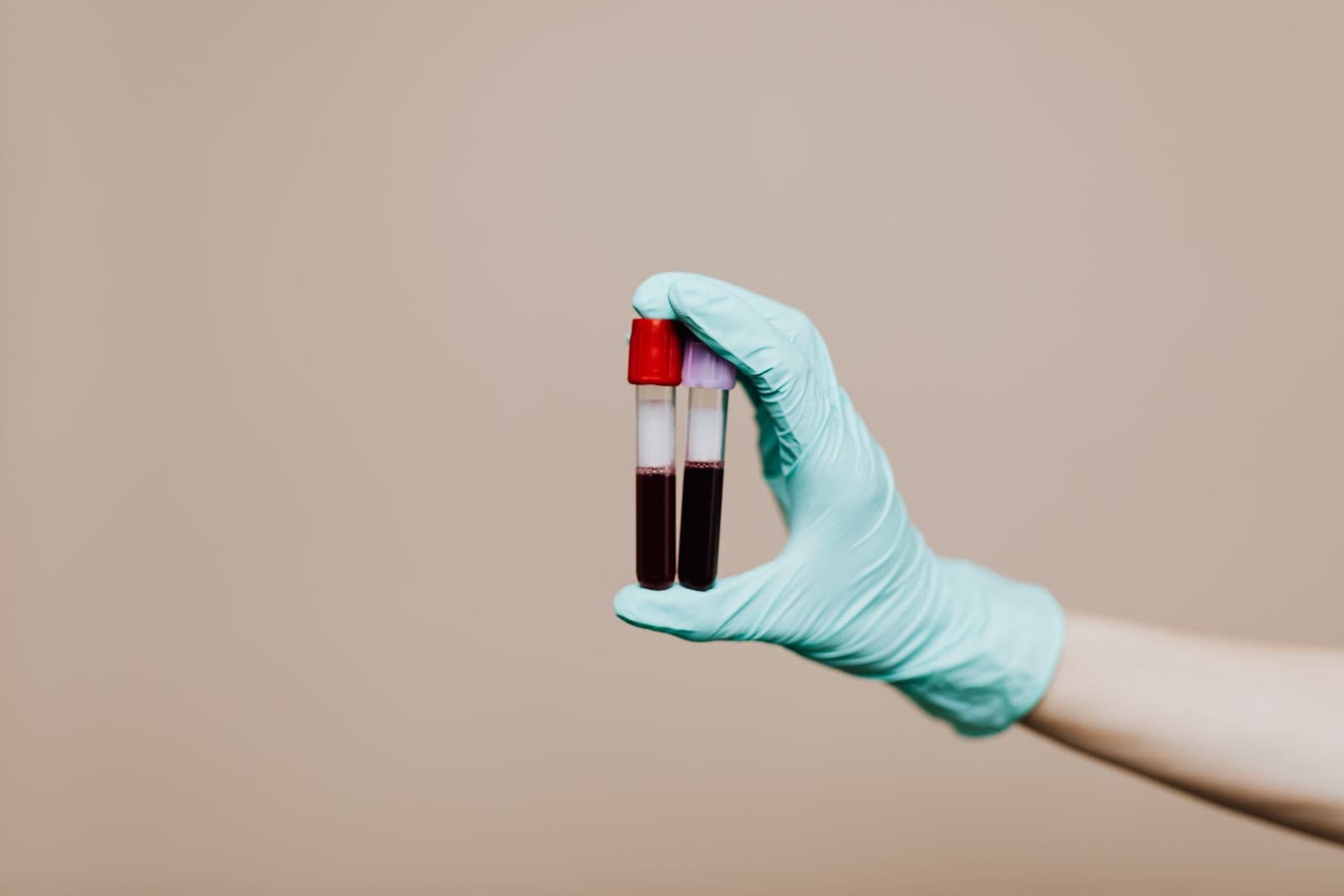 Gloved hand holding labeled blood sample tubes